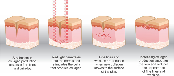 aging skin